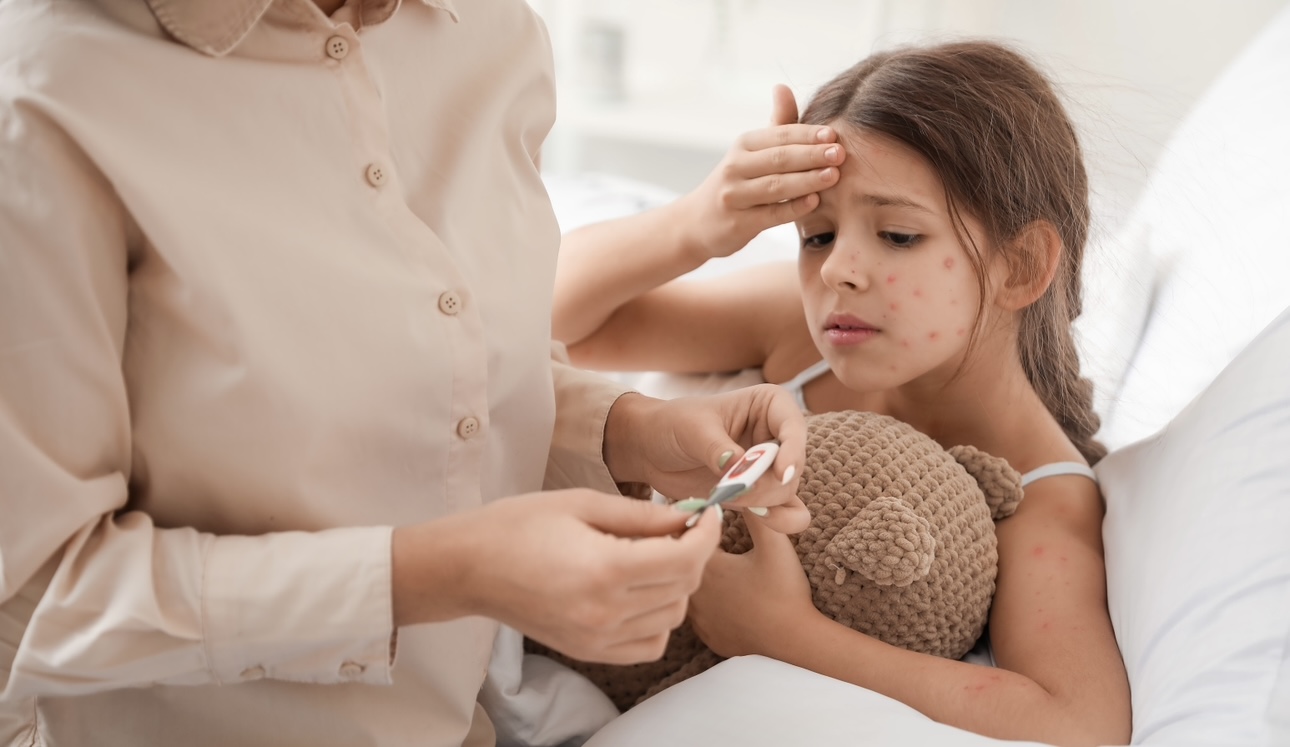 Врач Кондрахин назвал шесть фактов о ветрянке, которые нужно знать каждому