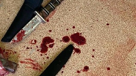 Полицейские рассказали о состоянии убийцы зампреда «Зов народа» Еговцева