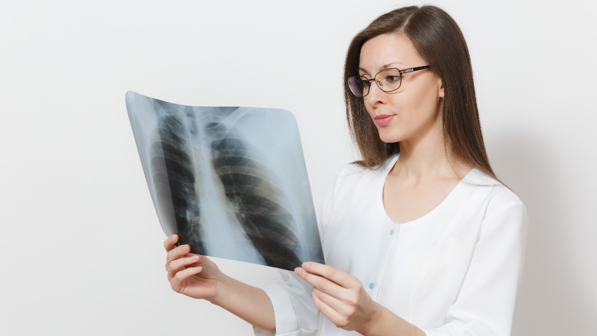 Аферисты интересуются процедурой флюорографии