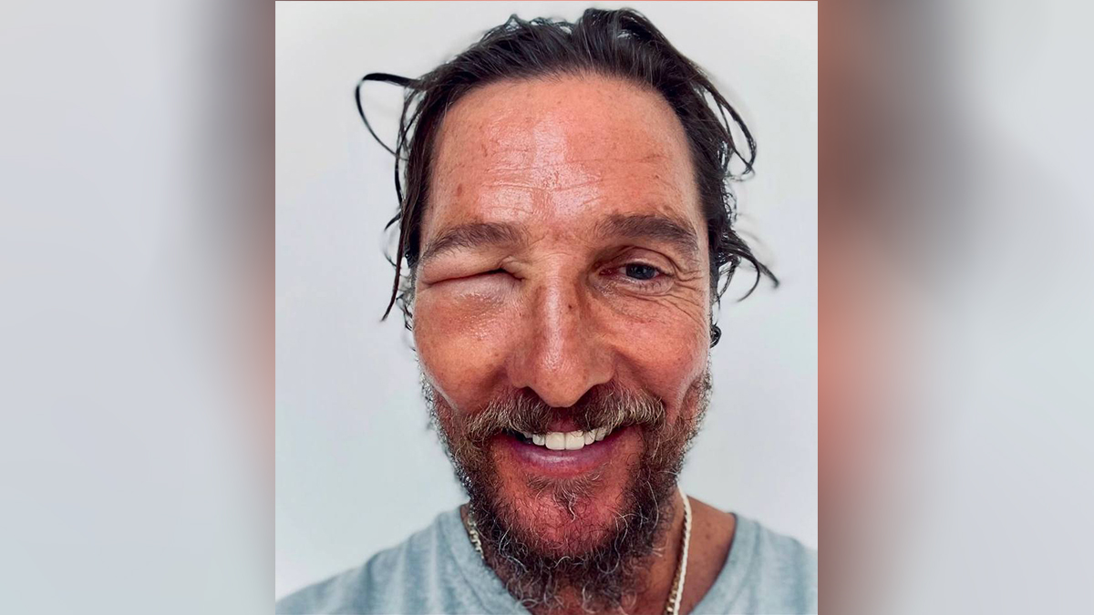 Пчела укусила американского актера Макконахи прямо в глаз