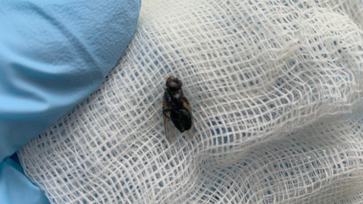 Врач извлек из носа 51-летнего мужчины живую муху