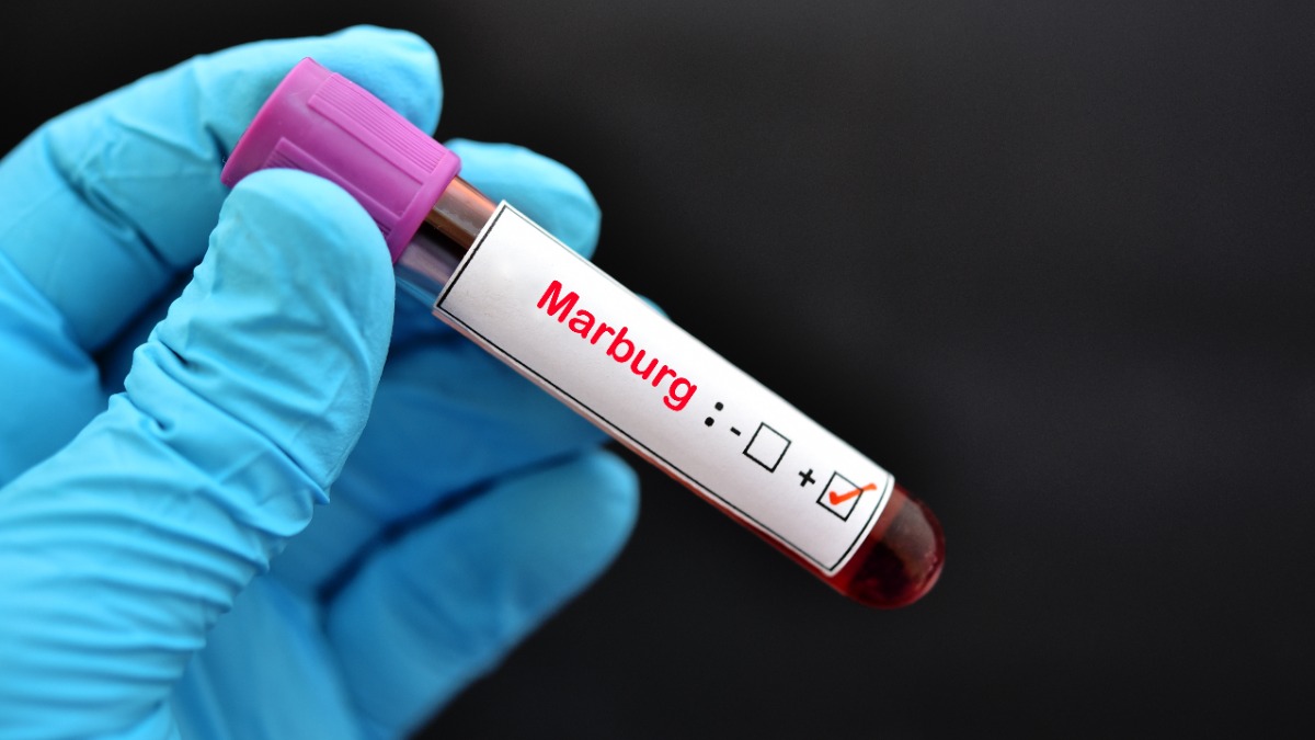 Первая группа опасности: доберется ли вирус Марбург с Украины в Россию