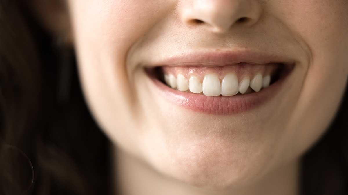 Стоматолог Чжан рассказал, на какие заболевания указывает цвет зубов