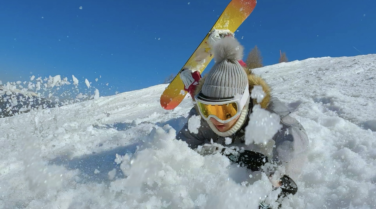 Никаких растираний: как лечить ушибы и синяки в период активного зимнего отдыха