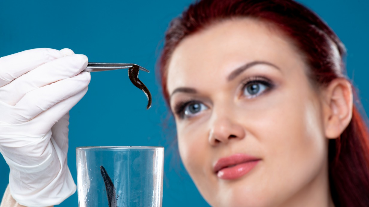 Лечение пиявками, или гирудотерапия — один из методов альтернативной медицины