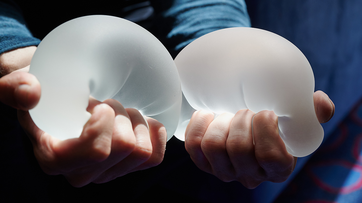 Когда нужно удалять грудные импланты