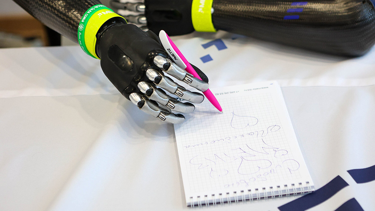 Школьнику, потерявшему пальцы при взрыве СВУ в Красногорске, сделали протез