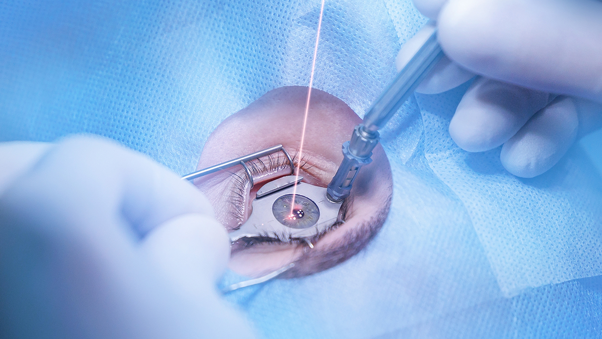 Коррекция зрения без операции: новый метод с электрическим током, риски