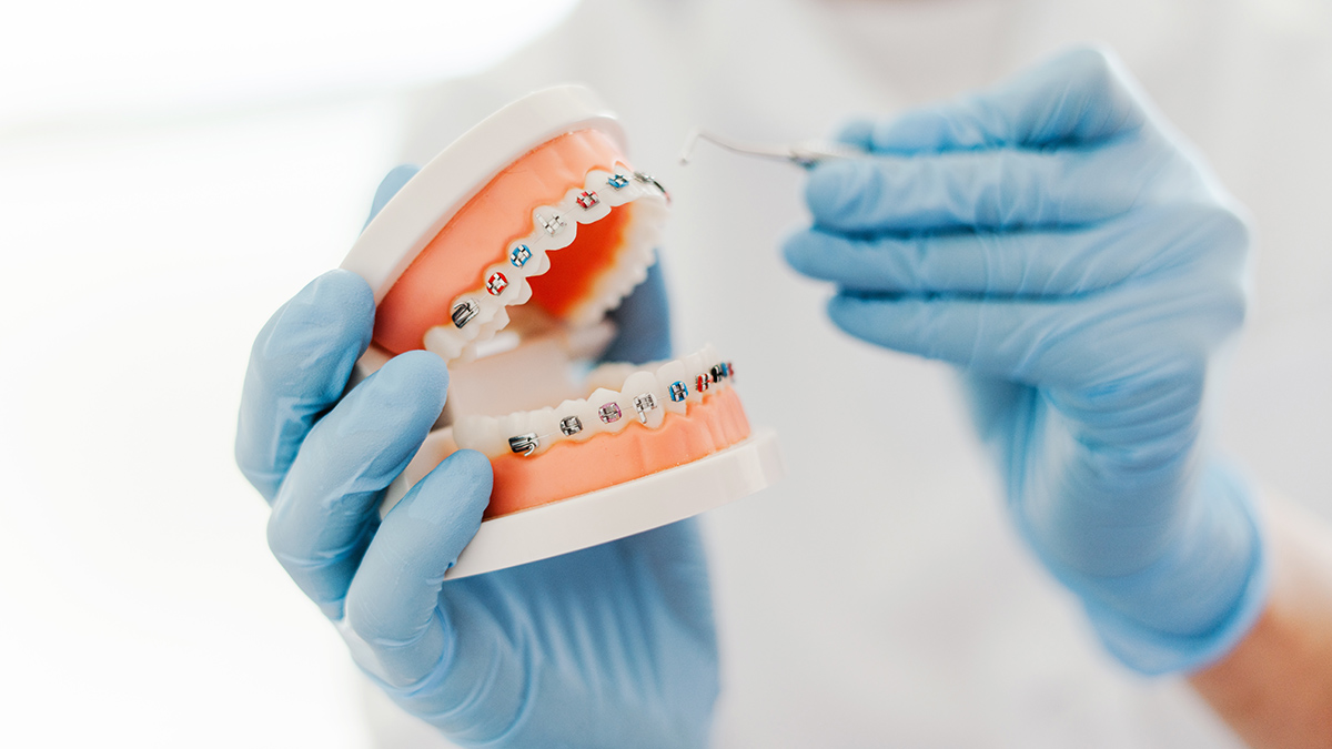 Как часто нужно посещать ортодонта