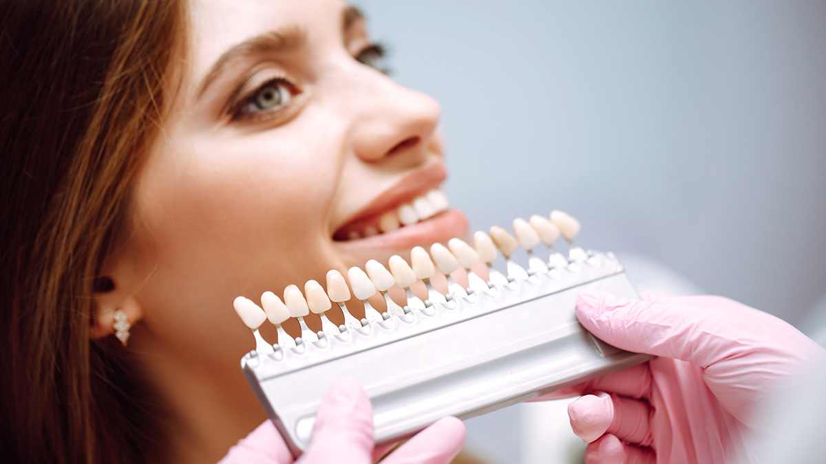 Чем коронки отличаются от виниров: как выбрать, польза для зубов, мнение стоматолога