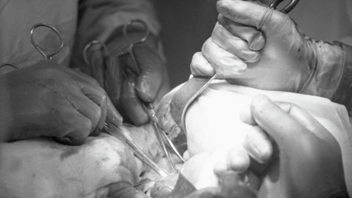 Дело главного уролога СССР Миловидова: как он «превращал» пациентов в инвалидов