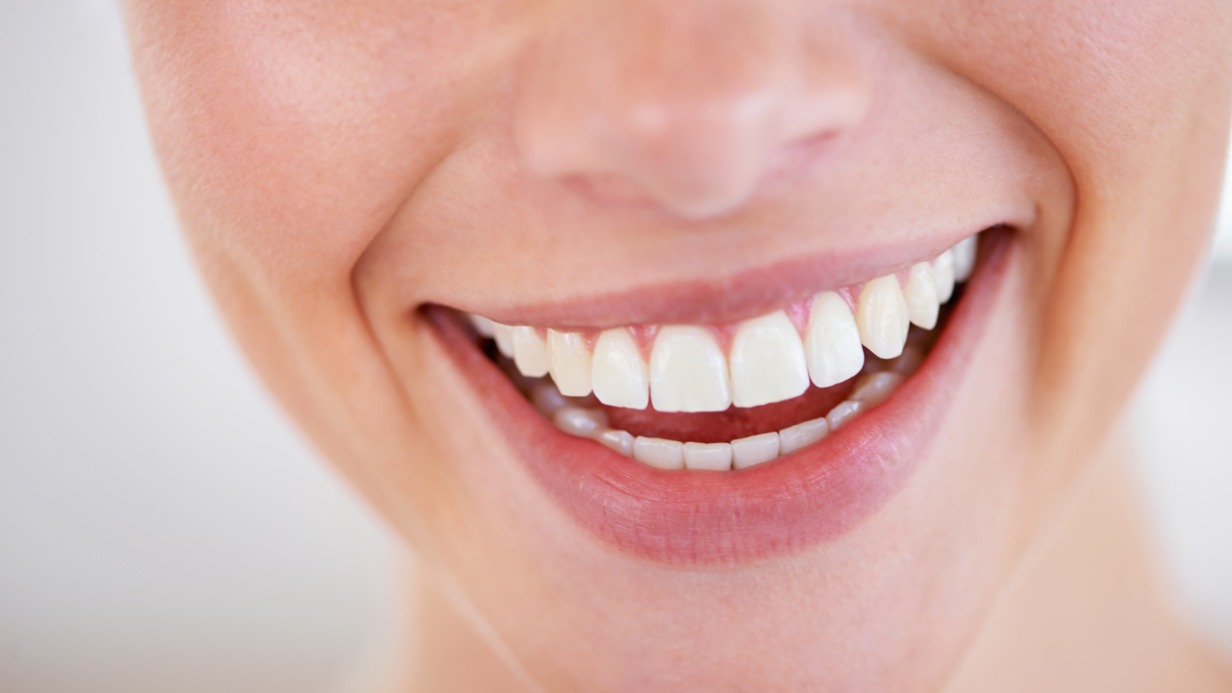 Сегодня «голливудская улыбка» может обойтись пациентам в целое состояние