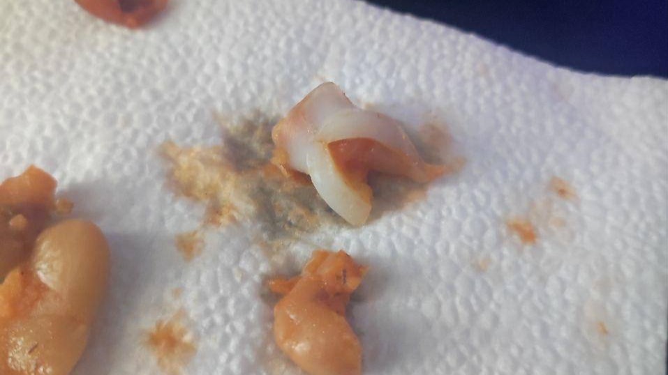 Зуб нашли в печеной фасоли из «Магнита» в Подмосковье