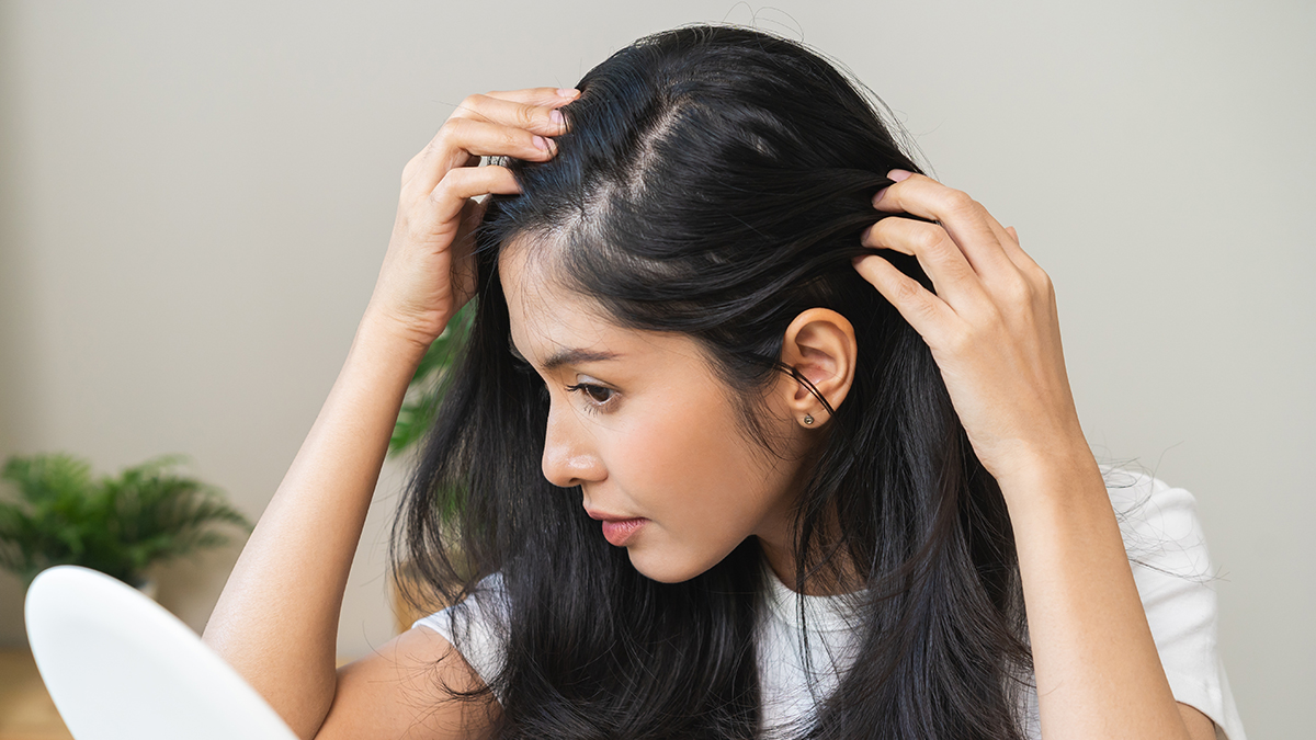 Почему у женщин появляются залысины