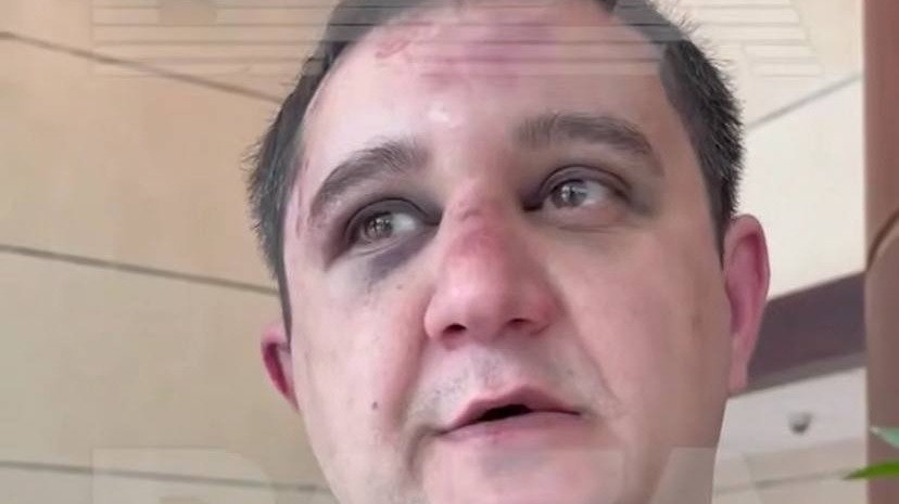 Ломали уши пистолетом: Щепихин рассказал, что с ним якобы делали чеченцы