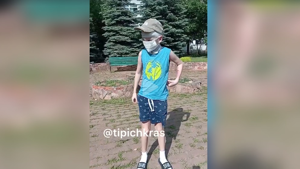 Появилось видео с мальчиком из Сочи, которому разорвали лицо собаки