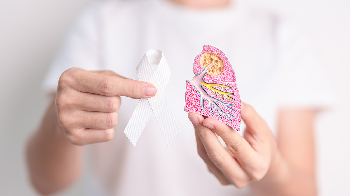 Cancer: Ученые создали онлайн-инструмент для борьбы с раком легких