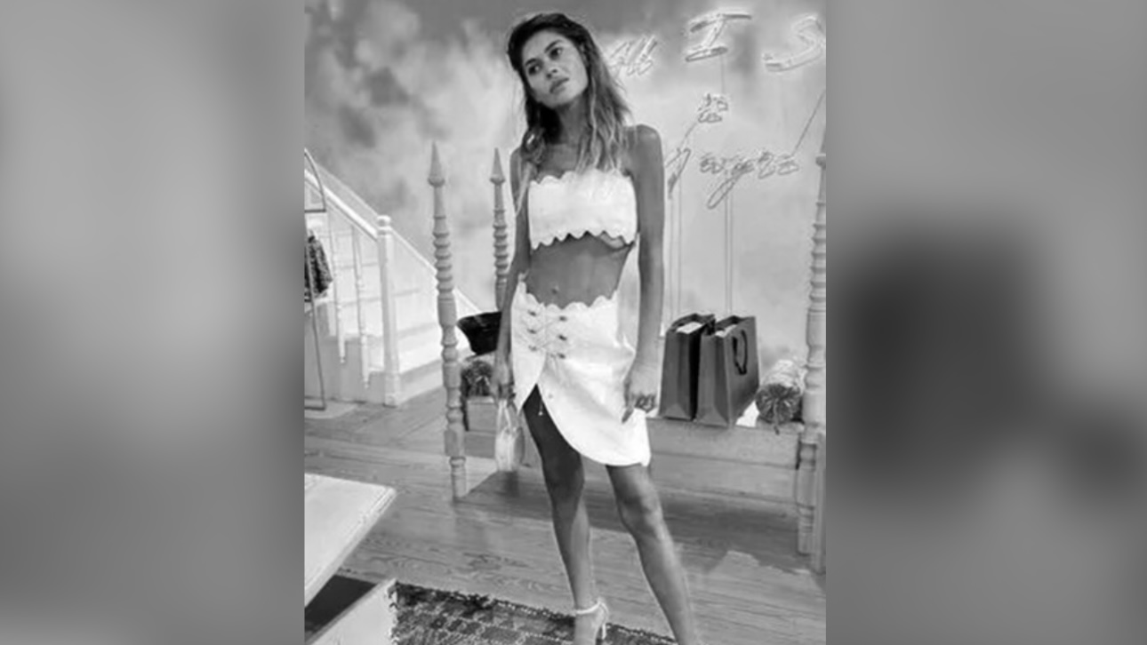 Турецкая звезда реалити-шоу умерла от анорексии, похудев до 22 килограммов