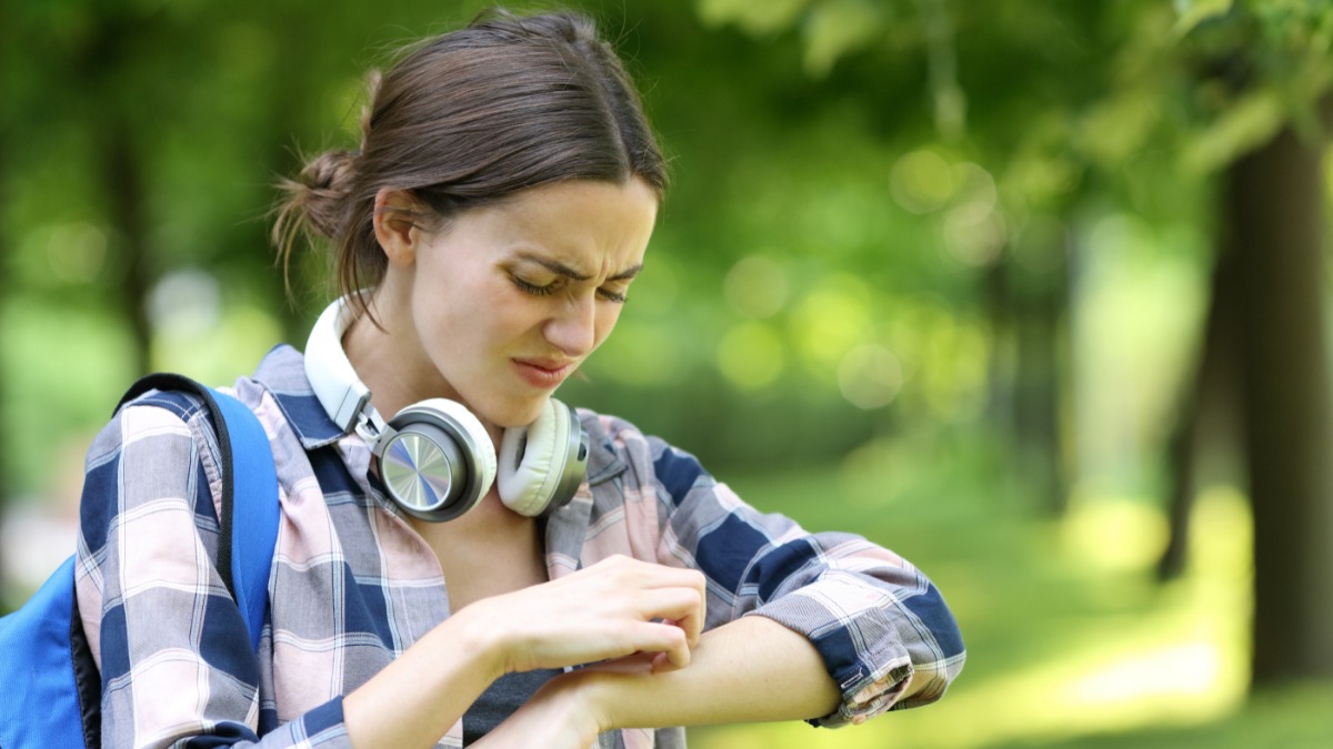 Укусы комаров могут быть опасны особенно для тех, кто подвержен аллергии и дерматиту