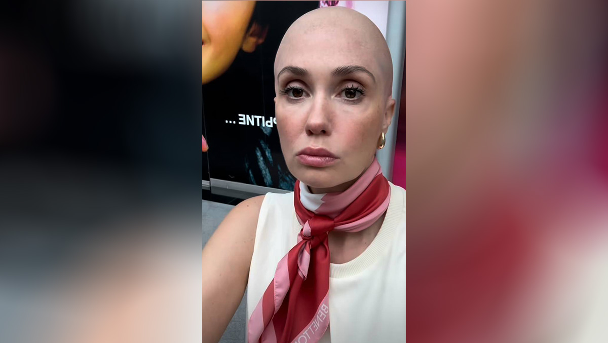 Беременная Муцениеце шокировала поклонников своей лысиной