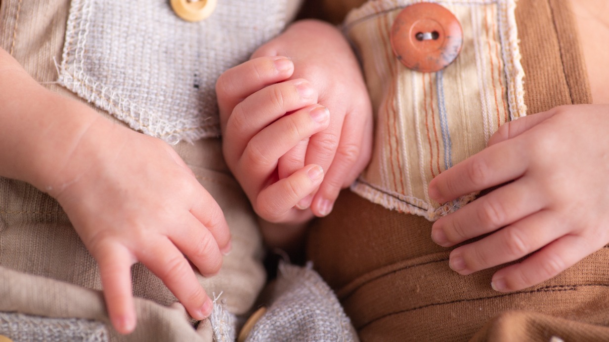 Самые известные сиамские близнецы