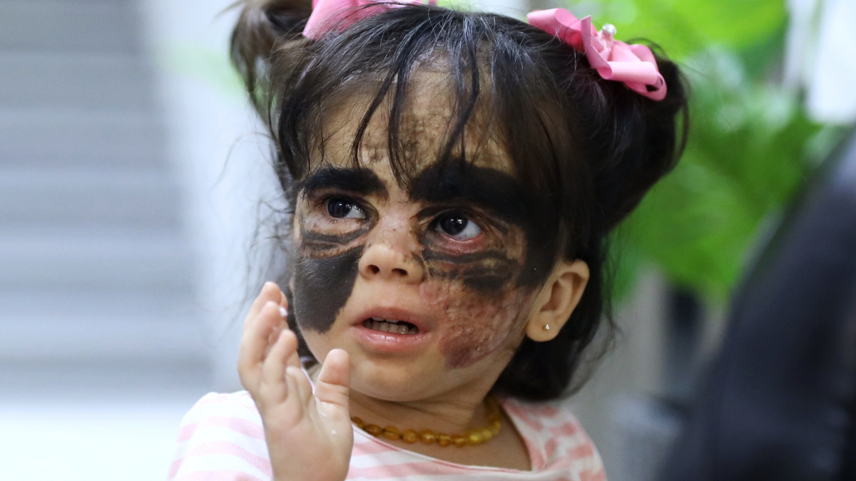 «Девочка в маске Бэтмена»: история, лечение