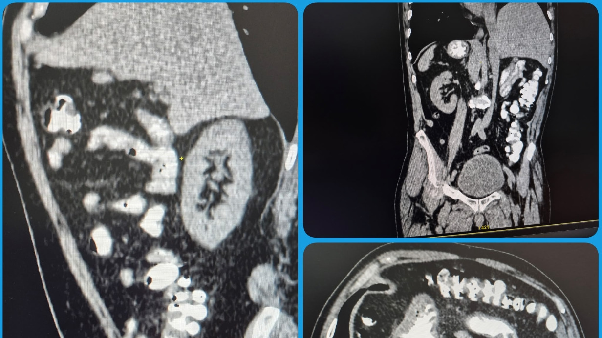 Саратовец случайно узнал о зеркальном расположении своих органов