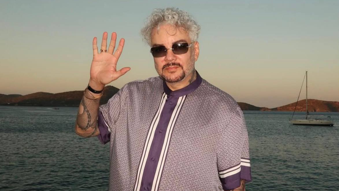 Киркоров впервые показал ожог на руке после инцидента с пиротехникой на концерте