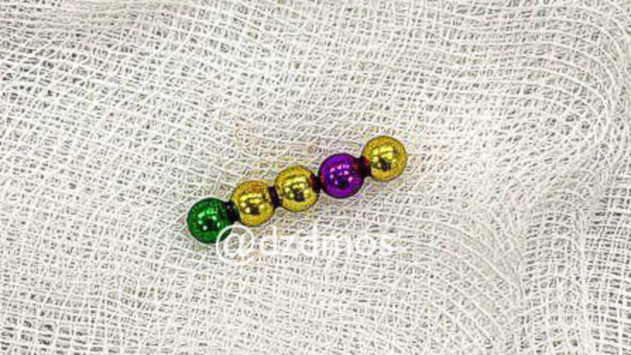 Пятилетняя москвичка проглотила магнитные шарики, которые продырявили кишечник