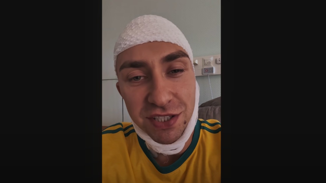 «Должен был умереть»: рэперу Гарри Топору удалили опухоль мозга