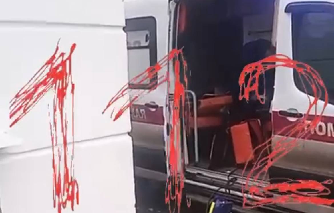 Буйный пациент разгромил машину скорой помощи в Москве