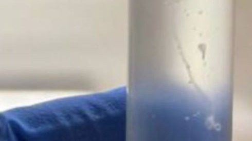 Врачи нашли живого червя в глазу у жительницы Омска