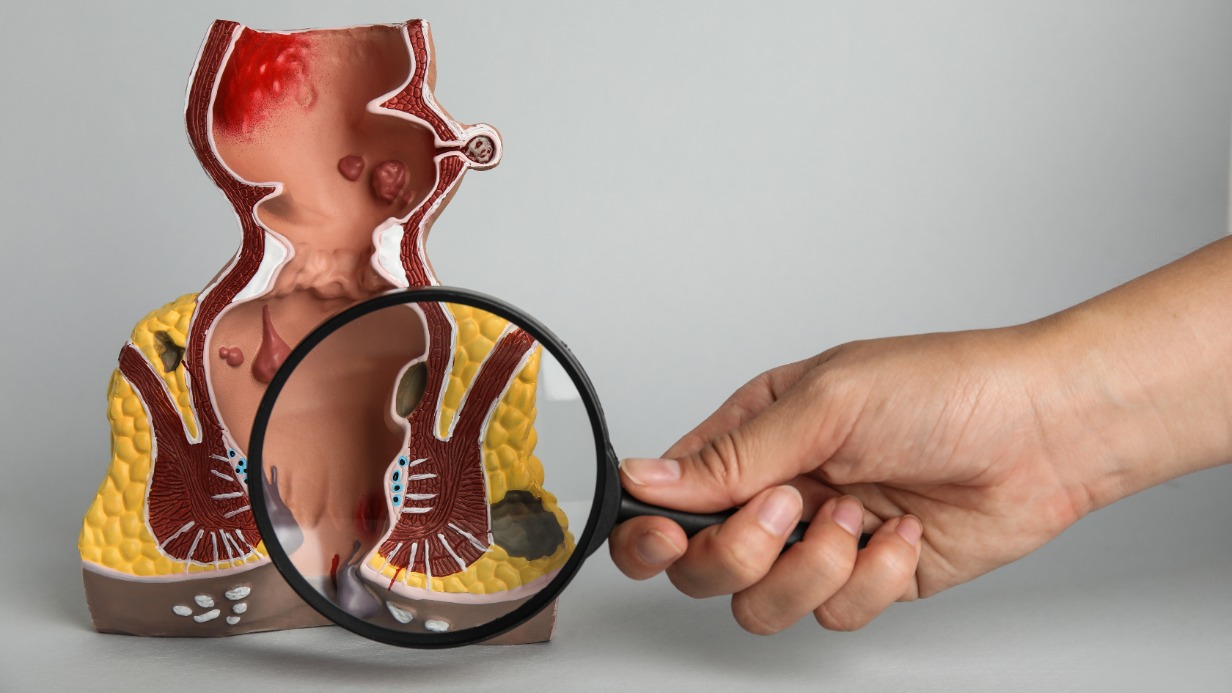 Как часто необходимо проверяться у проктолога; группы риска