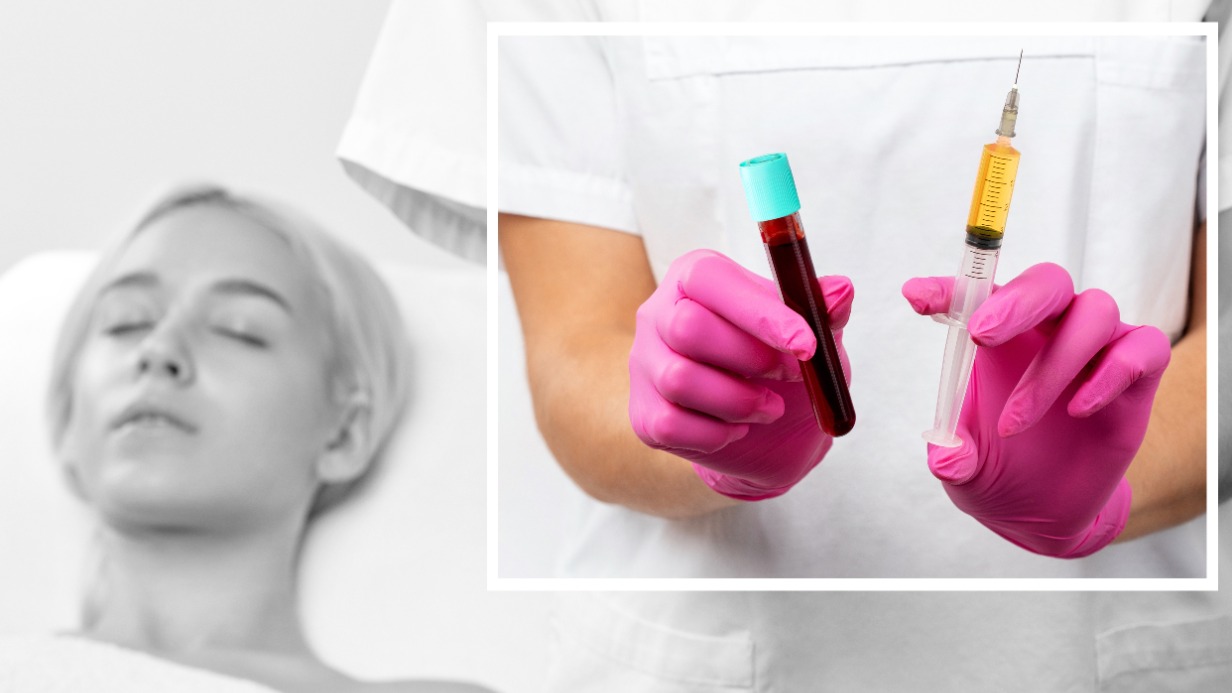 Что такое PRF и какой дает эффект