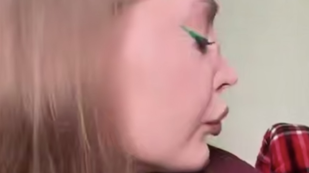 У москвички провалился нос: что такое аутоиммунный васкулит