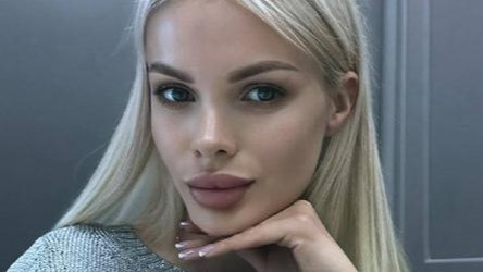 Лишилась половины черепа: избитая модель Анжелика Тартанова вышла из комы