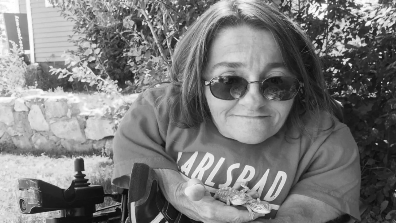 Умерла страдавшая болезнью «хрустального человека» актриса Мелани Уотсон