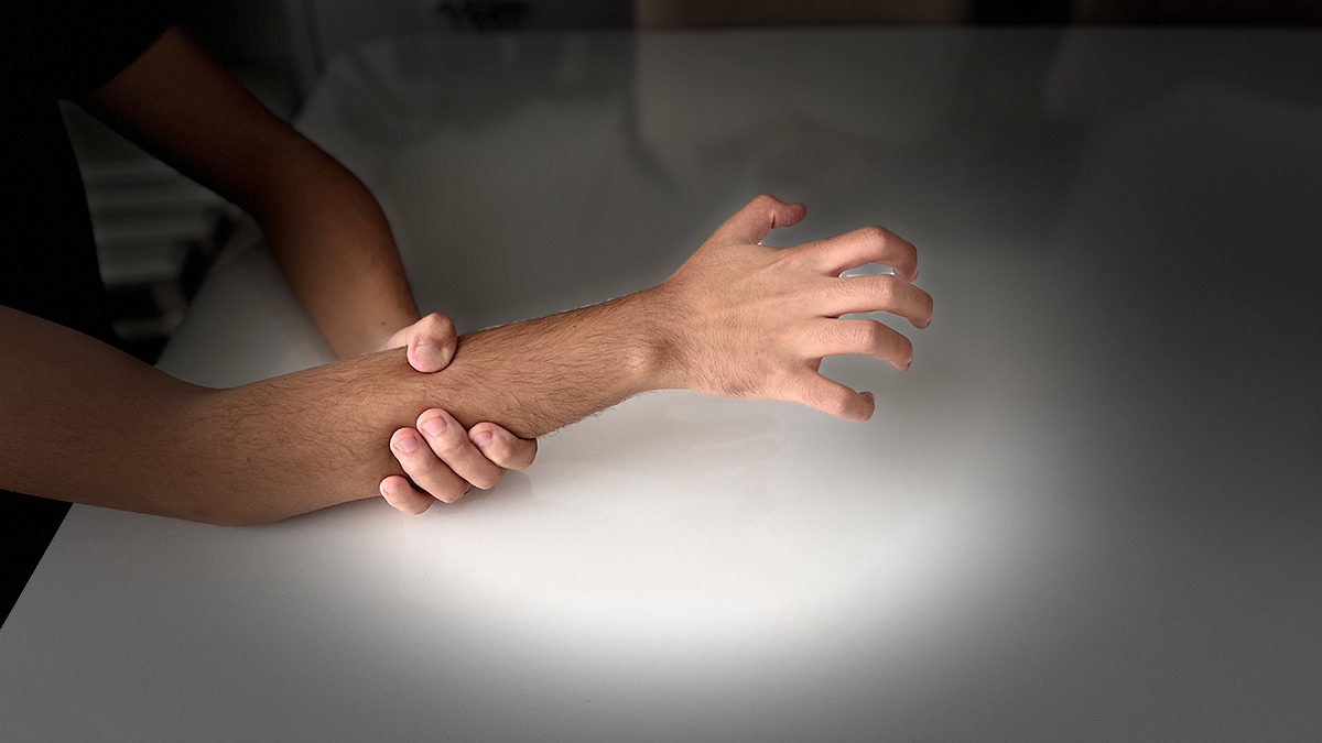 Синдром чужой руки: причины, симптомы, диагностика, лечение