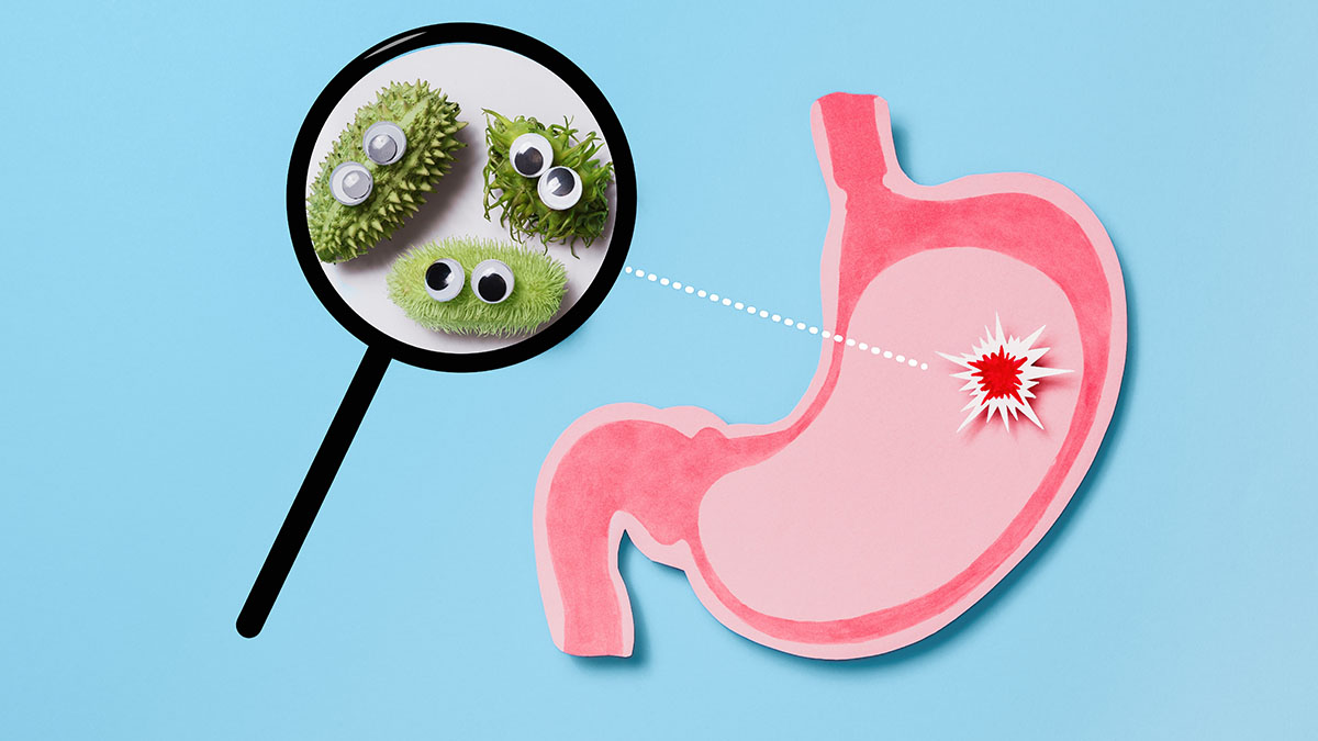 Что такое хеликобактер пилори, симптомы, опасность