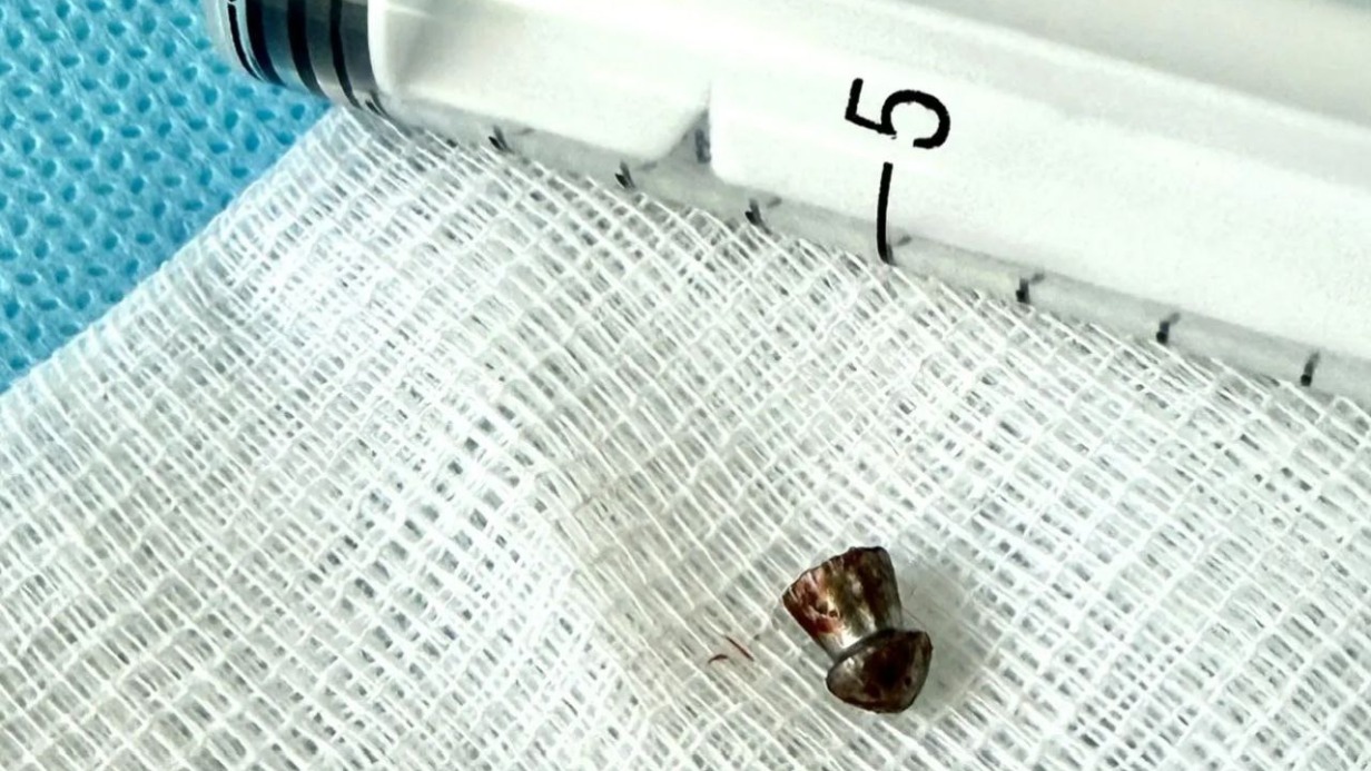 Мальчик в Приморье выстрелил из пневматики в лицо другу во время игры