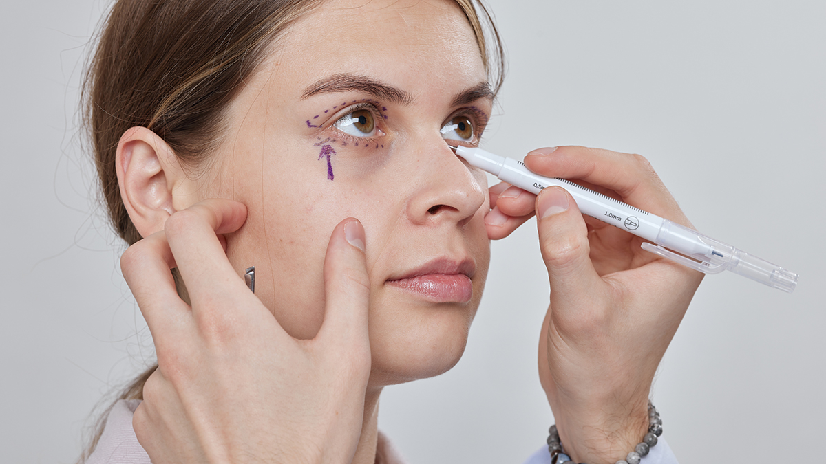 Какие могут быть осложнения после круговой блефаропластики