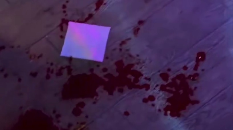 «Королеве красоты» изуродовали лицо на концерте «Тату» в Казани: полиция, личности нападавших и пострадавшей