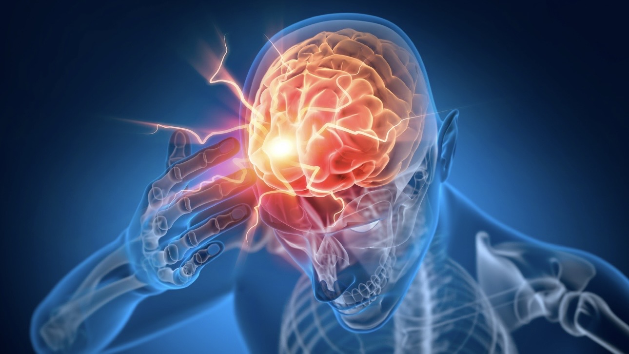 Эпилепсия: симптомы, почему возникает и как лечить