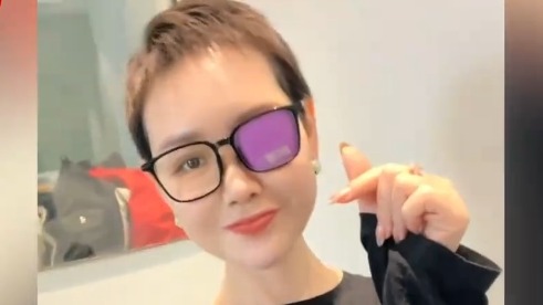 Ослепшая из-за рака китайская блогерша Чжу Минюэ скончалась в 41 год