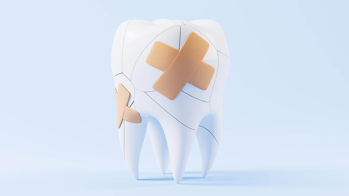 Откололся кусочек зуба: что делать
