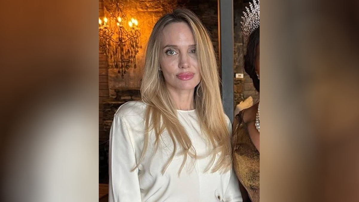 Что случилось с лицом Анджелины Джоли