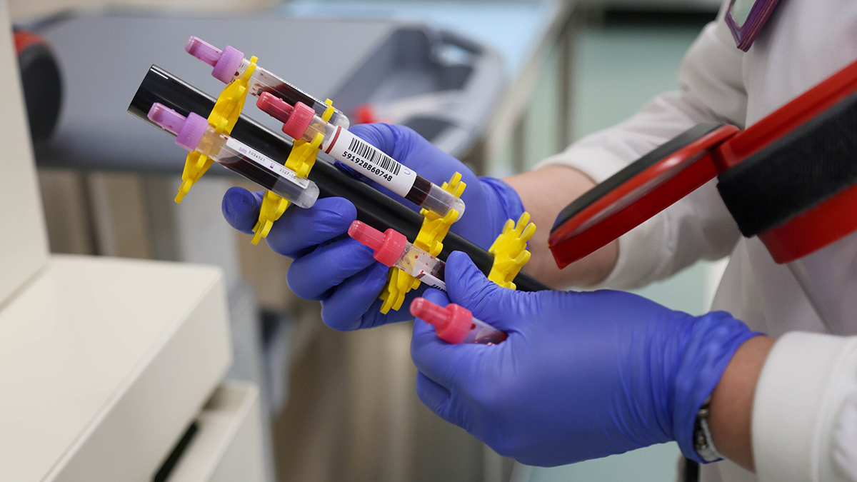 Какие обязательные анализы для проверки организма