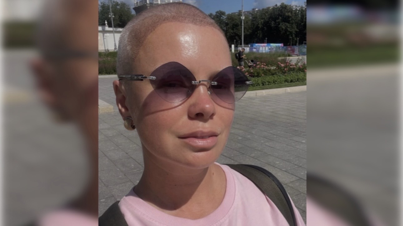 Актриса Евгения Осипова показала побритую голову после пересадки волос
