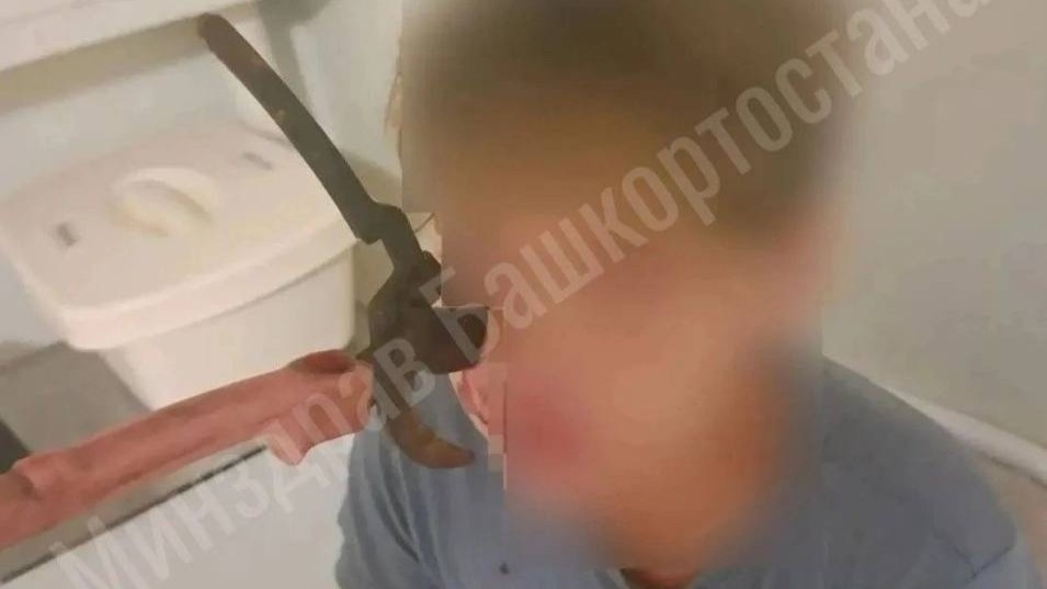 Секатор вонзился в лицо подростку во время игры с братом в Башкирии