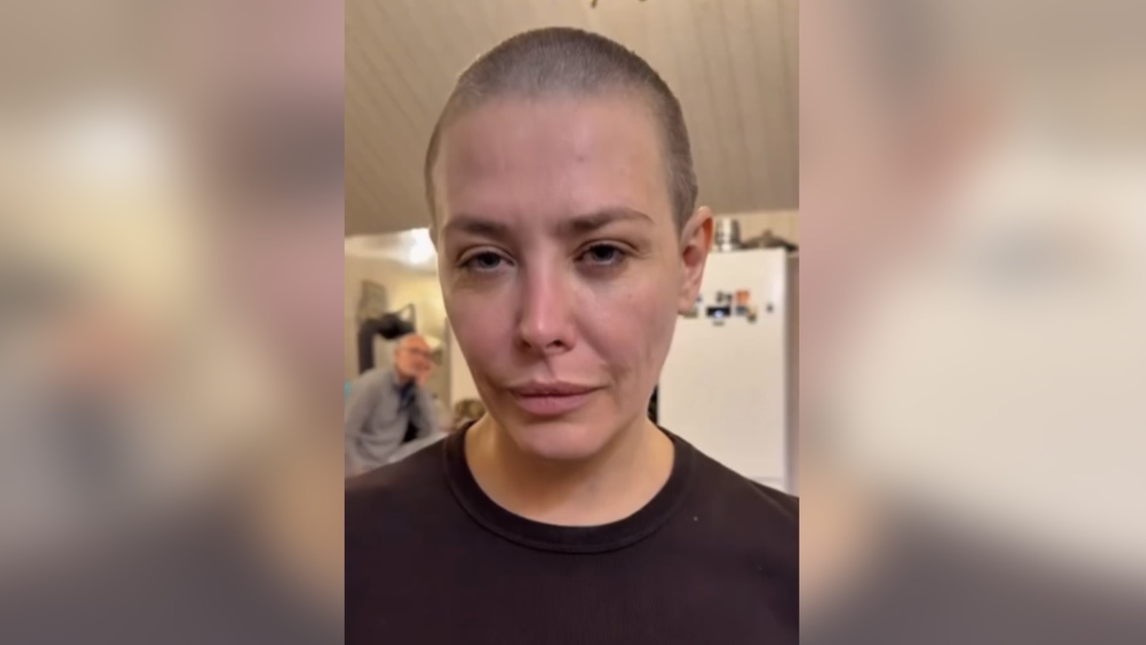 Актриса Екатерина Волкова побрилась налысо после операции